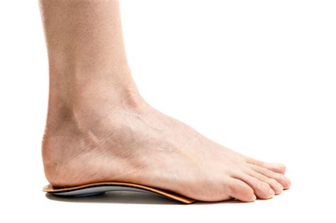 Premium Photo | Side view of female feet standing on orthopedic insoles ...