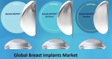 Breast Implants Finance