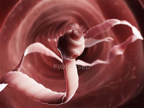 Tenia - Foto stock, immagini royalty free | Focused