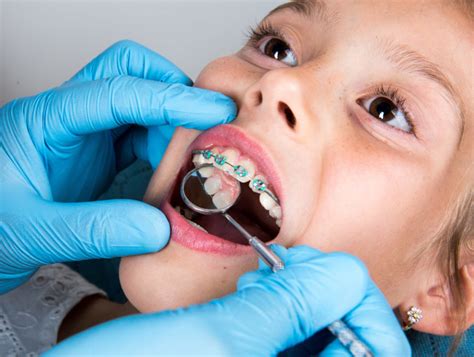 Top 5 Tips to Prepare Your Child for Braces & Orthodontics | Moles & Ferri