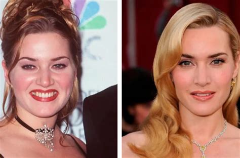 Imagefap Celebrities: Before and After – You Won't Recognize Them! - jdrkvdq