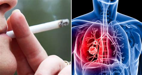 Research proves that getting cancer isn’t just “bad luck”