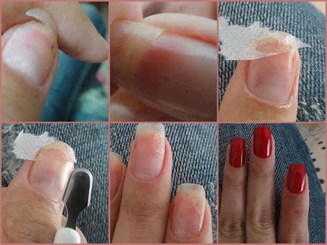 O Que Fazer Quando A Unha Quebra - Menina mimada : O que devo fazer quando minha unha quebra?