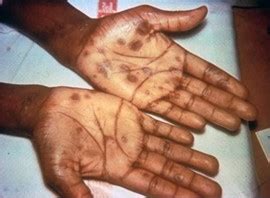 std education morehouse school  medicine