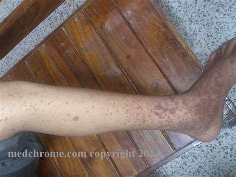 interesting medical cases spot diagnosis medchrome