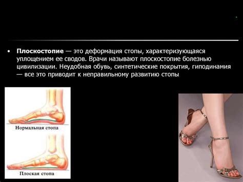 Сага о плоскостопии - презентация онлайн