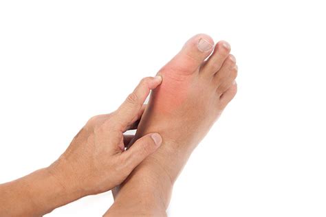 Gout - Foot & Ankle Institute of the West