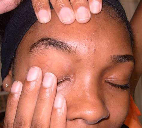 Bushy Eyebrows Before And After