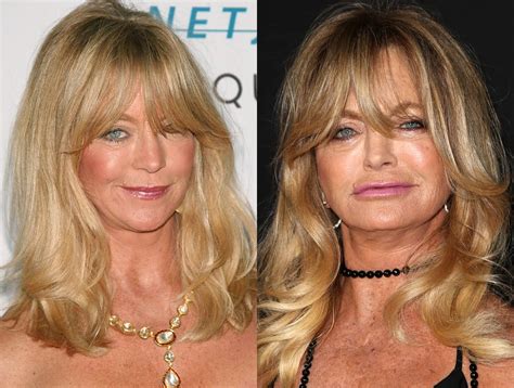 Goldie Hawn Before And After