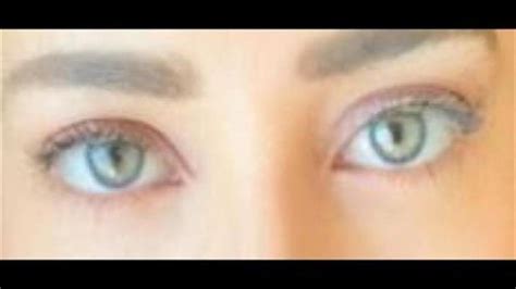 Eye Color Change Before & After with Change Color Eye Laser Eye Color ...