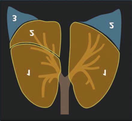 The visualization of the segments of a chest CT scan image, i.e., 5... | Download Scientific Diagram