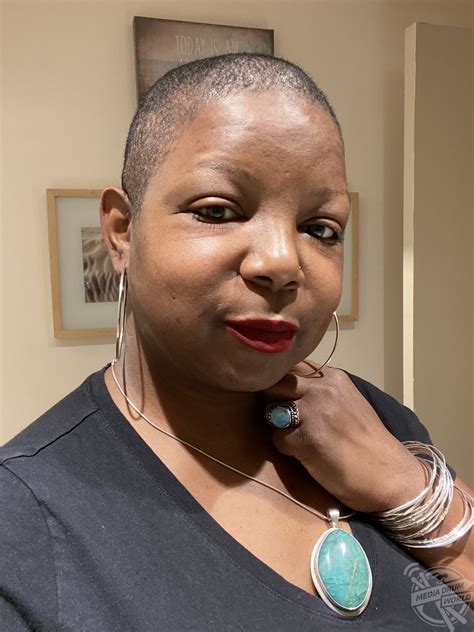 hair dye allergic reaction 12