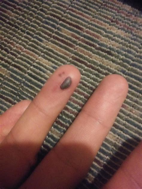 Why does my finger look so happy to get jammed into a goddamn door : r