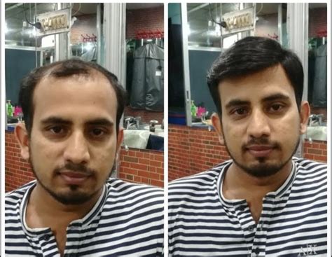 black men hair wigs  parlour  rs piece   delhi id