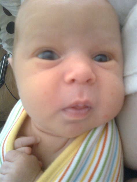 My Nipples Are Sore And Cracked From Breastfeeding - diamond dental