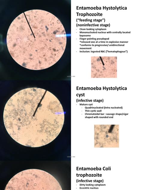 protozoan fecal smear  anatomy biology