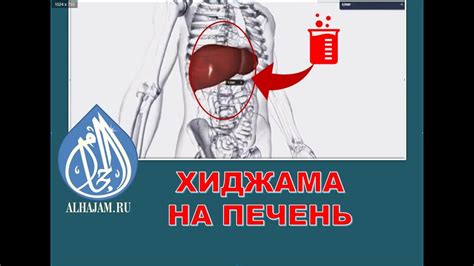 Хиджама на печень - YouTube