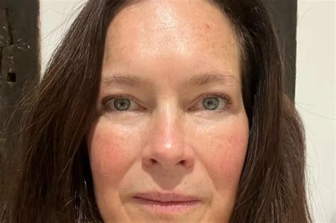 laser treatment  sevenoaks kent dr paulina charlesworth