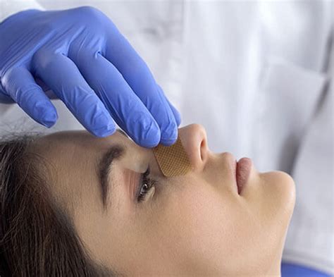 rhinoplasty avitia clinic
