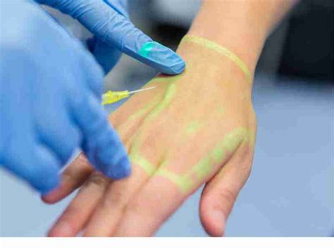 how to become a vascular access nurse
