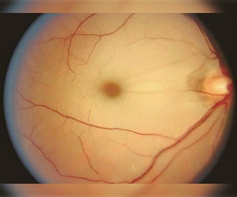 American Academy of Ophthalmology Joins Figure 1 | Figure 1