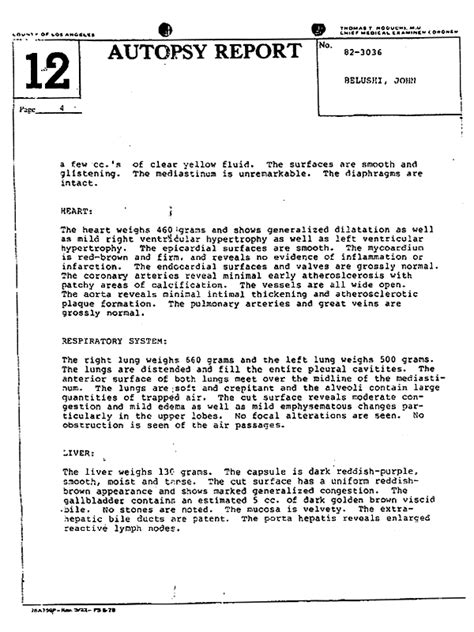 John Belushi, 20 Years Later | The Smoking Gun