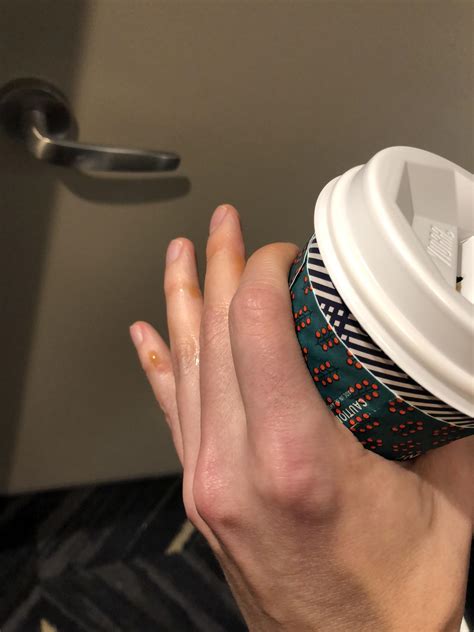 When coffee cups leak at the seam no matter where you position the lid