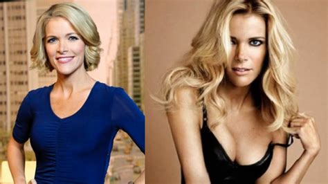 Megyn Kelly’s Plastic Surgery: What Happened to Her?