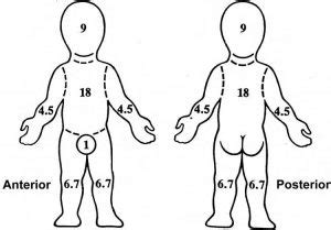 First Aid Management: Burns and Frostbite ! - Public Health Notes