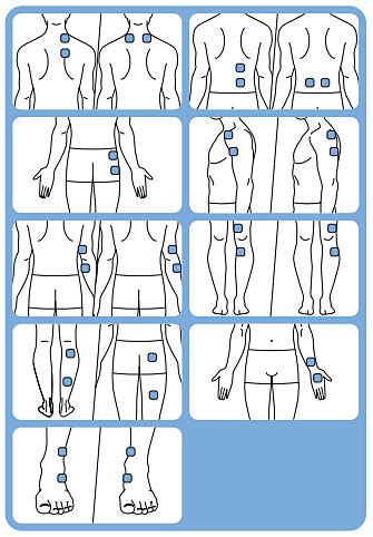 Where should I put the TensRelief electrodes? | Philips