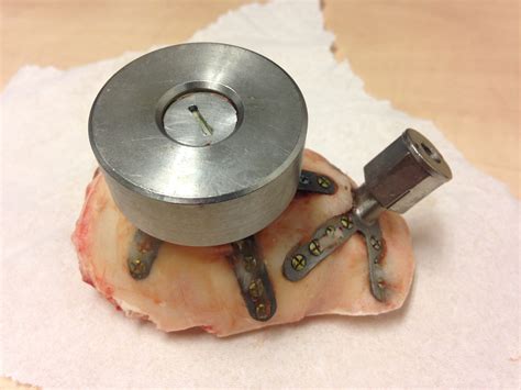 2021 Nestor – Brain implants for vision restoration – Drivers of Change