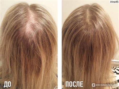 Сыворотка для волос Bio Hair Кератин - «Био Хайр (Bio hair) Лучшее ...