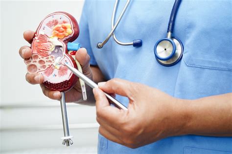 Nefrologista O Que É - Médico nefrologista: o que faz e quando consultar