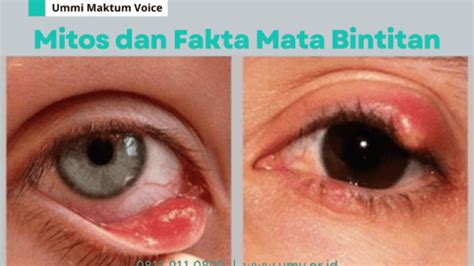 - Perkumpulan LSM UMMI MAKTUM VOICE