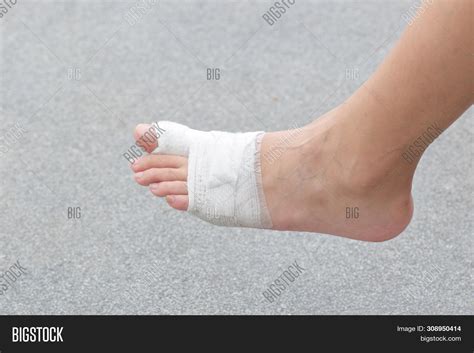 Injured Feet Wounds. Image & Photo (Free Trial) | Bigstock