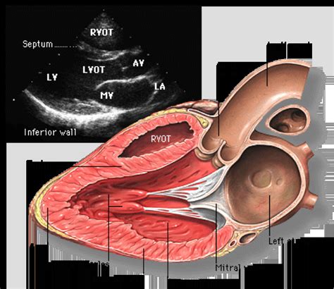 basics  echo cardiography echocardiogram xijmh