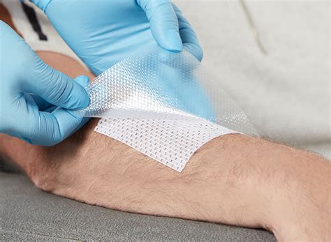 Silflex – Advancis Medical