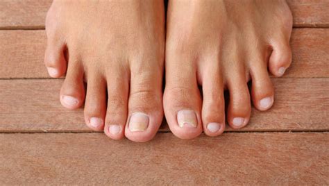 270+ Curved Toenails Stock Photos, Pictures & Royalty-Free Images - iStock