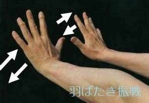 huntingtonmri kvhao