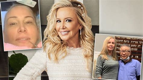 RHOC's Shannon Beador’s Plastic Surgery & Facelift Revealed