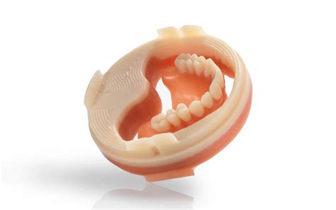 Ivoclar Ivotion Dentures | Ivotion Dentures | The Dental Laboratory