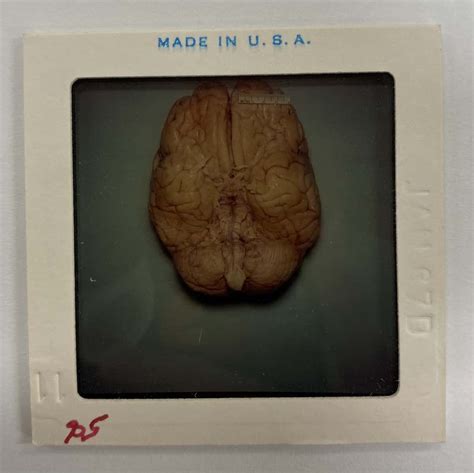 List 92+ Pictures President John F Kennedy Autopsy Photos Stunning