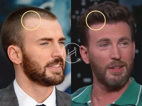 captain america chris evans hair