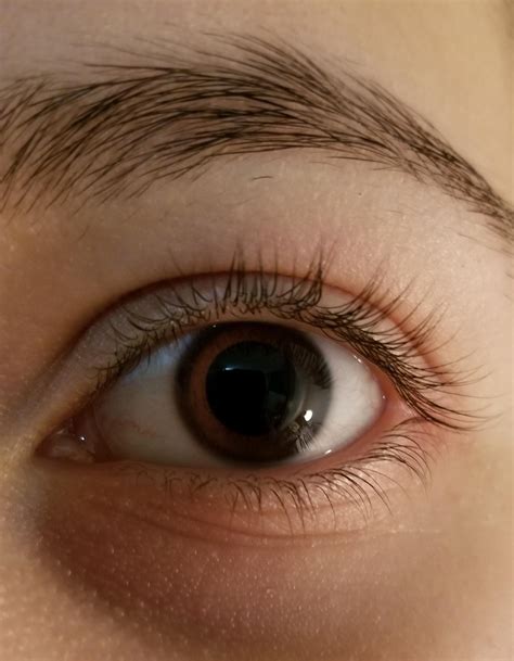 Smart Tips About How To Get Rid Of Dilated Eyes - Dugdrive82