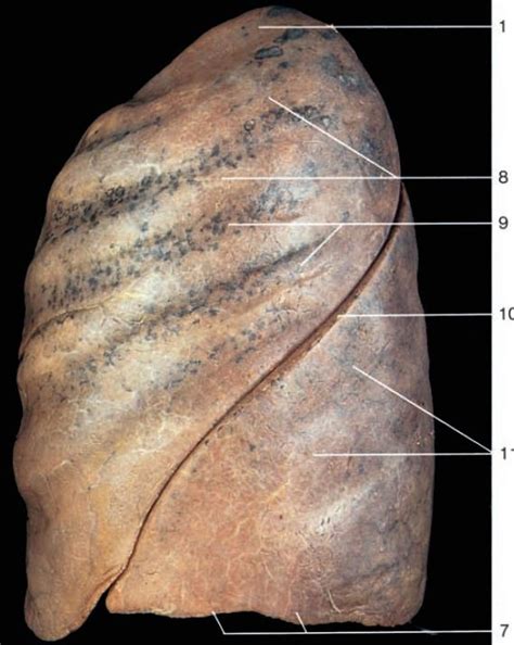 diagram  left lung lateral quizlet
