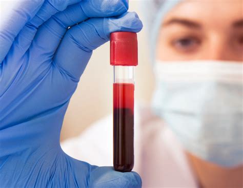 Quanto Custa O Exame De Sangue - exame-sangue-img