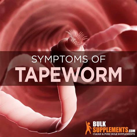 Taeniasis (Tapeworm): Causes, Symptoms & Treatment