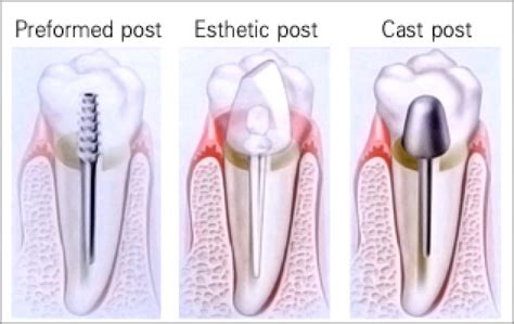 post  core phuket dental care