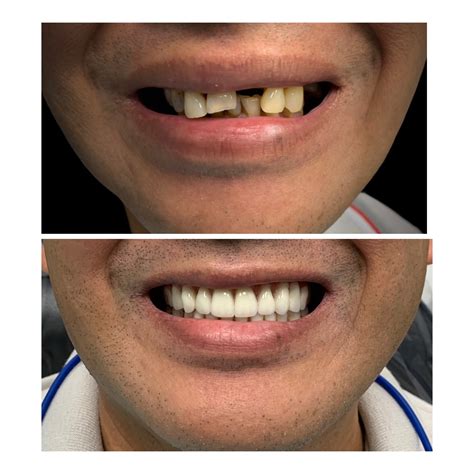 NASHVILLE DENTURES AND IMPLANTS