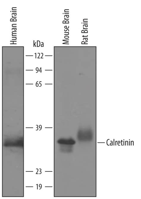 Calretinin Antibody [Unconjugated] (AF5065): Novus Biologicals
